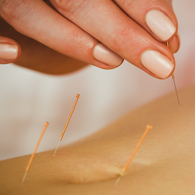 Soulager les douleurs  avec  l'acupuncture